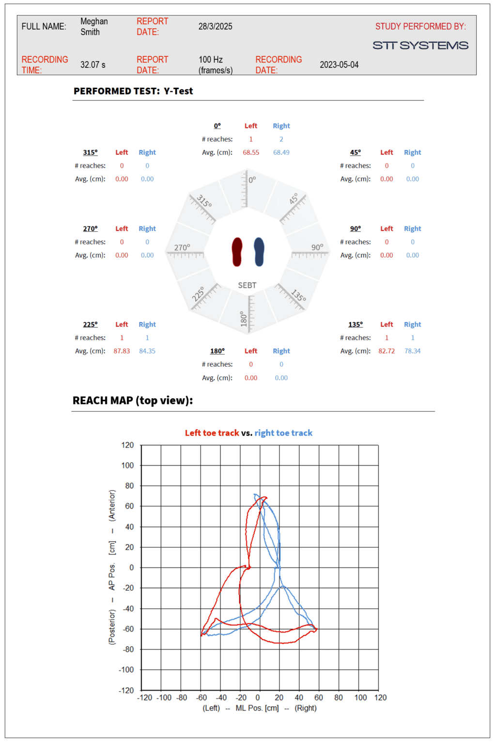 Clinical Success with the 3DMA System: Biomechanical Gait Analysis in ...